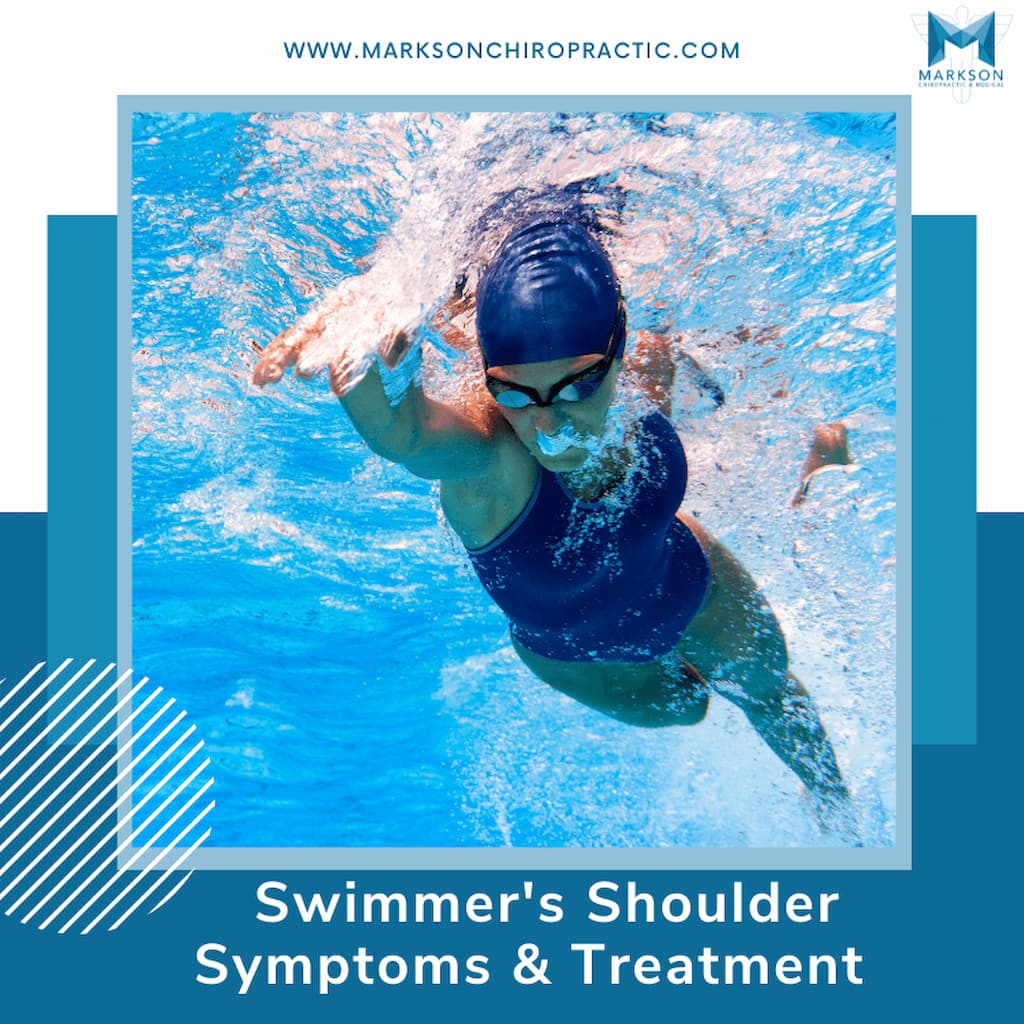 Swimmer's Shoulder Symptoms & Treatment